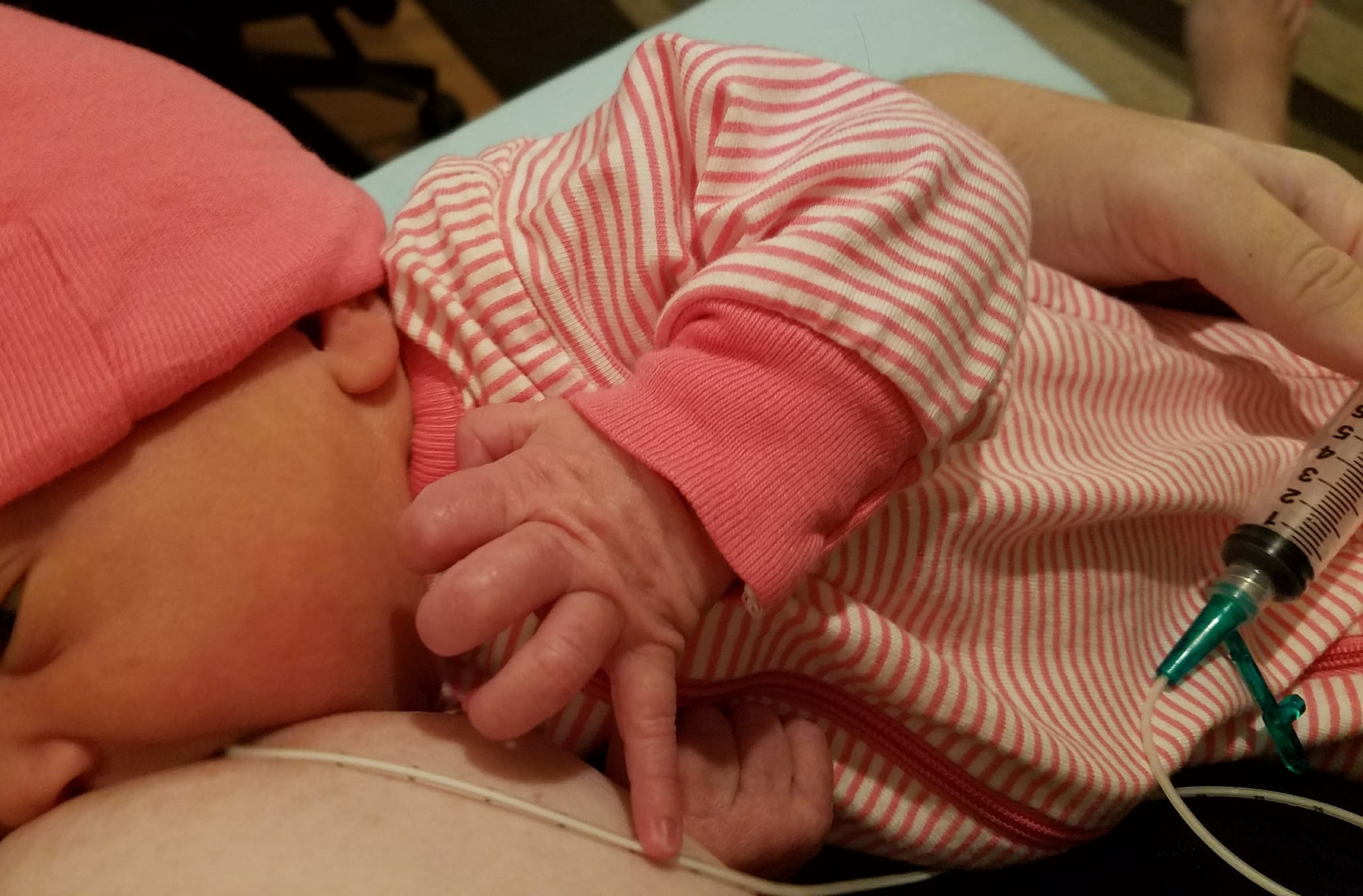 Seen here is a 4 day old infant latched and nursing. A small tube is inserted into the latch which allows the infant to consume additional expressed milk or formula - while also nursing. The benefits to this process include stimulating milk production as the child continues to suckle, and avoid nipple confusion if the family does not plan to use bottles. It can also be helpful in the case of thrush infection, if the infant has stopped wanting to suckle due to assoxisted pain. The pictured mother has a lot of experience using this system - but it can be difficult to get the hang of. It is easiest to prepare the syringe(s) ahead of a nursing session. This mother used this system twice with each of her children, for about 2.5-3 weeks.