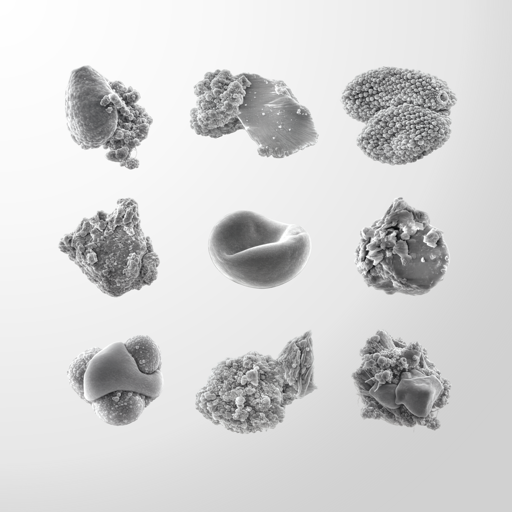 This image set shows micrographs of airborne particulate matter collected in Astana, Kazakhstan. Particulate matter consists of microscopic solid and liquid particles suspended in the air. These particles originate from both natural sources and human activities, such as traffic, heating, and industrial processes. Due to their small size, particulate matter can be inhaled deep into the lungs and may contain harmful substances, contributing to respiratory and cardiovascular health problems.
Technical Methodology and Equipment 
The PM sampling campaign: 
The sampling campaign was conducted from October 2021 to June 2023, covering a total duration of 194 days of sample collection. PM was collected using a Partisol 2025i-D Dichotomous Sequential Air Sampler (Thermo Fisher Scientific Inc., San Jose, CA, USA), which simultaneously captures both fine (PM2.5) and coarse (PM2.5–10) fractions. The sampler installation was performed according to U.S. EPA 40 CFR Part 58, Appendix D and Appendix E siting criteria. The virtual impactor of the air sampler separated the airflow to maintain a steady flow rate of 15 L/min and 1.67 L/min for PM2.5 and PM2.5–10, respectively. Samples were collected on 47 mm polytetrafluoroethylene (PTFE) filters (2 µm pore size) over 24 h periods during a two-year campaign, yielding 194 samples for each PM fraction. Filters were pre- and post-conditioned in a controlled environment (30–40% RH, 20–23 °C) for at least 24 h and stored at 4 °C in Petri dishes prior to analysis. Gravimetric analysis was performed using a RadWag XA 220.3Y (RADWAG, Radom, Poland). Analytical balance and PM mass concentrations were calculated in μg·m−3.
Morphological Characterization of PM:
Fine particulate matter (PM2.5) (n = 10) and coarse particulate matter (PM2.5–10) (n = 10) samples collected during July and January were selected to investigate seasonal (summer–winter) variations in particle morphology, potential dominant sources, and the impact of the heating season. Each filter was sectioned into 1 mm2 fragments, mounted on carbon tape, and coated with a 15 nm Au layer, using a Q150T sputter coater to enhance conductivity. Morphological characterization was conducted using a field emission scanning electron microscope (FE-SEM, ZEISS Crossbeam 540 (Carl Zeiss AG, Oberkochen, Germany) equipped with ORS Dragonfly Pro 2021.3 software. Analyses were performed under high-vacuum conditions (10−5 mbar), with a working distance of 3.6 mm, an accelerating voltage of 5 kV, a scan speed of 3, and a probe current of 117 pA. These settings enabled the detection of particulate matter with diameters as small as <100 nm.
Scientific Value:
1) Provides direct morphological evidence of PM2.5 and PM2.5–10 particle types in Astana, Kazakhstan, where such data are currently very limited.
2) Confirms strong seasonal contrasts in emission sources, with combustion-related particles dominating in winter and dust- and traffic-related particles prevailing in summer.
3) Enables source identification through characteristic particle morphologies (soot aggregates, coal fly ash, mineral dust, biological particles), complementing chemical and receptor-model analyses.
4) Reveals particle size and shape features relevant to inhalation behavior and respiratory deposition.
5) Supports assessment of potential health risks associated with different particle morphologies.
6) Establishes baseline microscopic evidence for urban particulate matter in Central Asia, supporting future air quality and health-impact studies.
Co-authors of the scientific article in which these micrographs were published:

Akmaral Agibayeva, Aiganym Kumisbek, Aslan Nauyryzbay, Egemen Avcu, Kuanysh Zhalgasbayev, Ferhat Karaca, and Mert Guney.