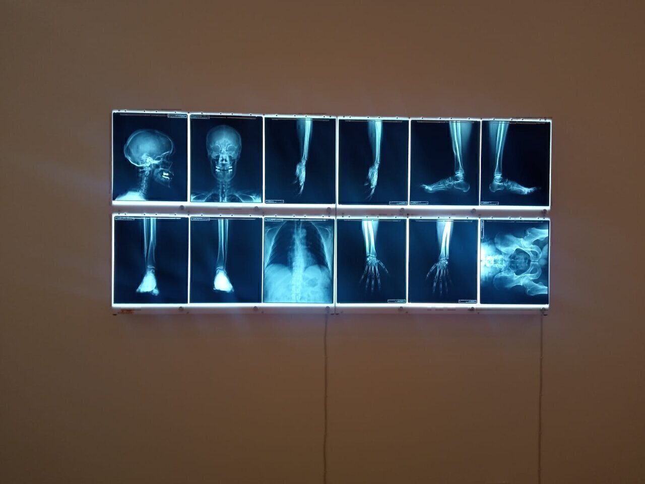 Fotografía a esta hombra del artista Damien Hirst en la exposición elaborada este año en el Museo Júmex