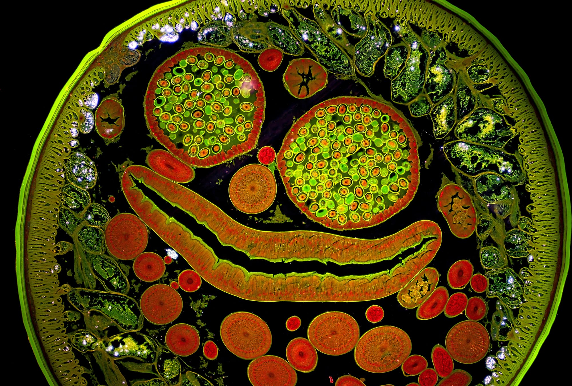 section of female Ascaris photographed with Nikon 1,40 Darkfield oil condenser. 200 magnification. The large circles filled with small green circles are the uterus and eggs. The long narrow feature is the digestive tract. The smaller red and orange circles are the ovaries and oviducts. The cluster of green and black blobs in the upper right and lower left are the nerve cords (ventral and dorsal). Surrounding the internal organs are the frilly green longitudinal muscles, the dark hypodermis, and the green outer cuticle.
