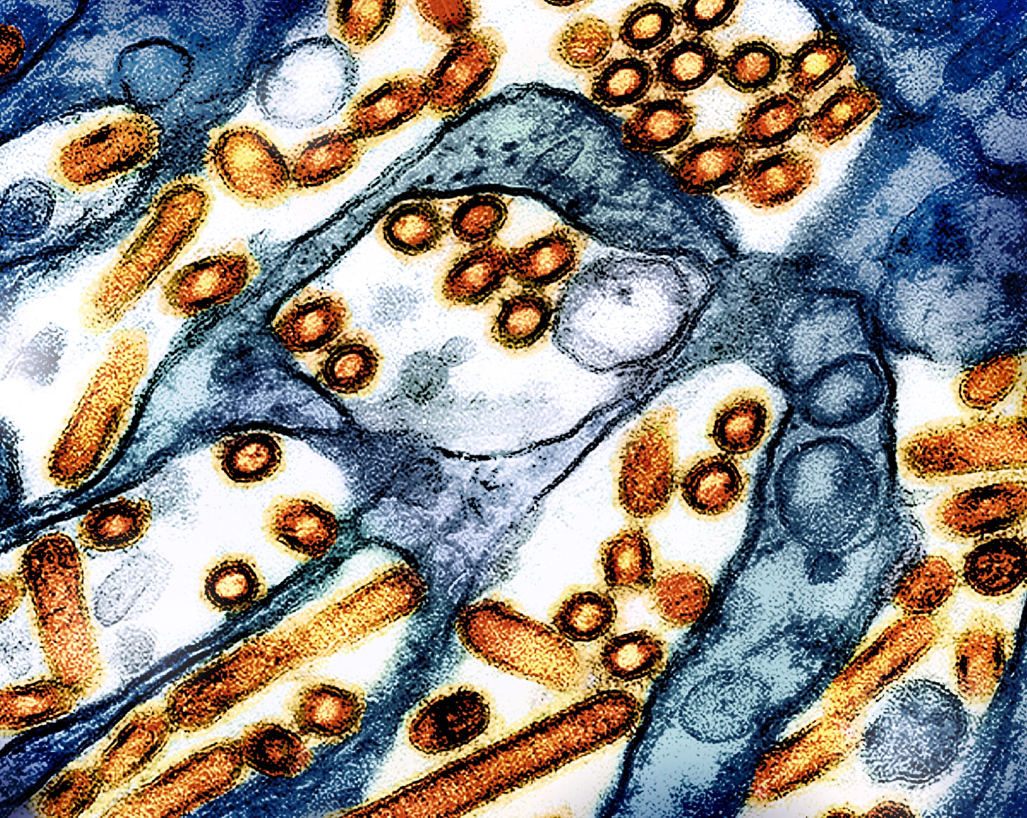 Colorized transmission electron micrograph of avian influenza A H5N1 virus particles (red/yellow) grown in Madin-Darby Canine Kidney (MDCK) epithelial cells. Microscopy by CDC; repositioned and recolored by NIAID. Credit: CDC and NIAID