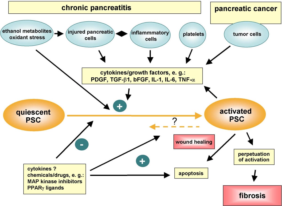 Pancreatic stellate cell activation in chronic pancreatitis and pancreatic cancer. Pancreatic stellate cells are activated by profibrogenic mediators, such as ethanol metabolites and cytokines/growth factors. Perpetuation of stellate cell activation under persisting pathological conditions results in pancreatic fibrosis.


Jaster Molecular Cancer 2004 3:26   doi:10.1186/1476-4598-3-2