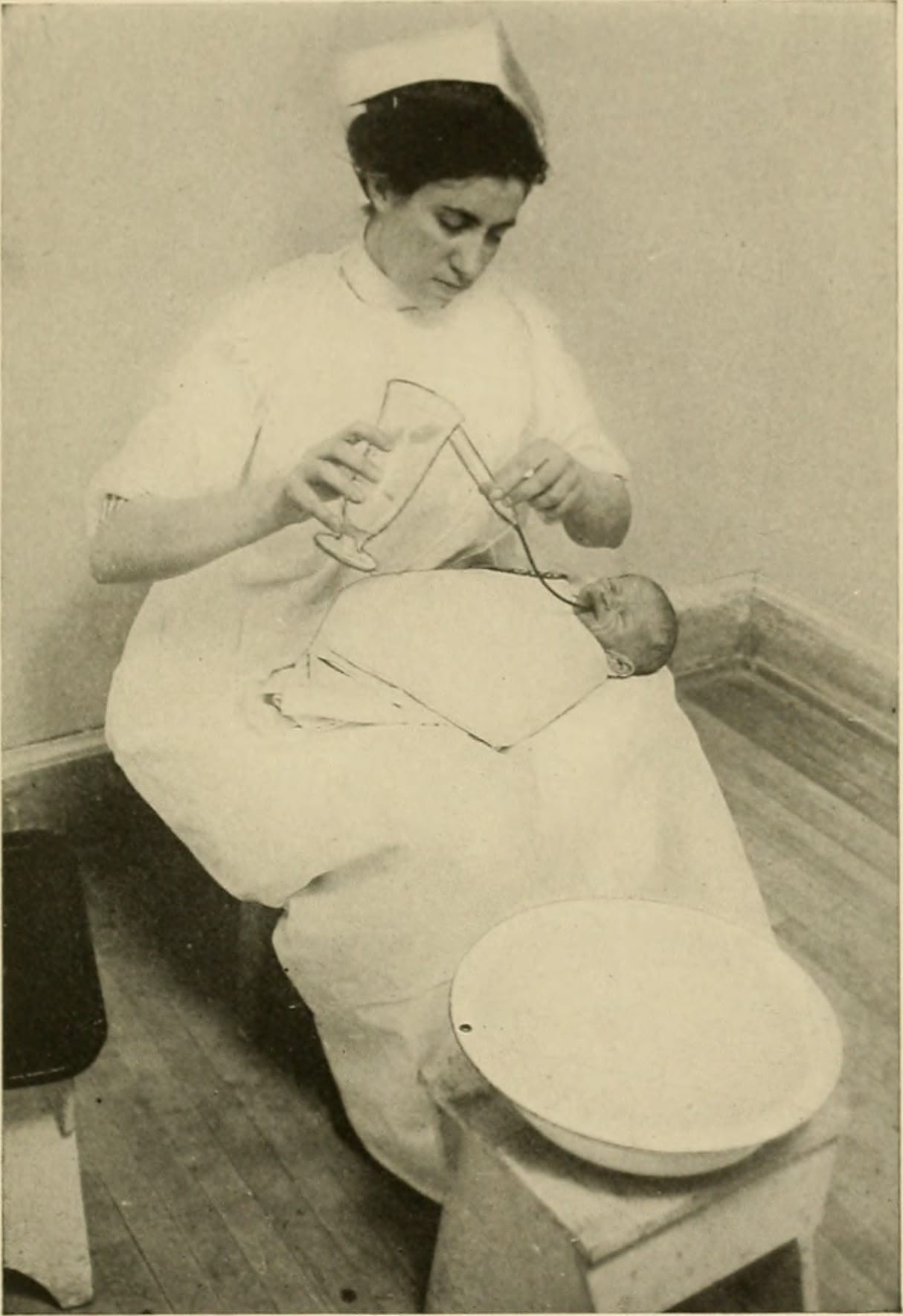 Identifier: infantfeeding00grul
Title: Infant feeding
Year: 1914 (1910s)
Authors:  Grulee, Clifford G. (Clifford Groselle), 1880-1962
Subjects:  Infants Infant Food Feeding Behavior
Publisher:  Philadelphia, London, W. B. Saunders
Contributing Library:  Columbia University Libraries
Digitizing Sponsor:  Open Knowledge Commons
View Book Page: Book Viewer
About This Book: Catalog Entry
View All Images: All Images From Book
Click here to view book online to see this illustration in context in a browseable online version of this book.
Text Appearing Before Image:
mirable results maybe obtained by a temporary diet of diluted skimmed milk.This should only be resorted to in severe cases, since prop-erly dosed whole milk dilutions are usually sufficient.Where the case is a severe one, stomach-washing is fre-quently indicated. Often one washing is enough to pro-duce a cure; sometimes it must be repeated once a day forseveral days. In cases accompanied by much gas, a mix-ture of charcoal in milk of bismuth,^ although of unsightlyappearance, may give excellent results. The second type has been so thoroughly discussed underthe various nutritional disturbances previously treated inthis work that no further attention will be given it here.The third type will be taken up in the chapters devoted toinfant feedings in parenteral diseases. One should alwaysbear in mind the vomiting of intussusception. As to projectile vomiting, it is usually associated with 1 About 2 or 3 grains of charcoal to a half-teaspoonful of milk ofbismuth one-half hour after feeding.
Text Appearing After Image:
Fig. 27.—Stomach washing. SYMPTOMS AND THEIR CAUSES 239 acute cerebrospinal meningitis, but this disease is for-tunately not very common during infancy, so that thistype is not often seen. In congenital pyloric stenosis,which is seen most often in very young infants, the vomit-ing is very frequently of this type. METEORISM Meteorism may be due to one or both of two factors:accumulation of gas in the intestines from decompositionof the food and paresis of the intestinal wall. The sig-nificance of its presence depends, in large measure, uponthe general condition of the infant. In a child with in-toxication, meteorism is a sign of marked disturbance ofthe intestinal blood-supply (paresis of the intestinal wall),and hence is a serious condition. On the other hand, a moderate distention of the abdomenin a dyspeptic breast-fed infant is an aggravating, but nota serious, symptom. The condition occurs rather frequently in cases of dys-pepsia and intoxication, and occasionally in weight dis-
Note About Images

Please note that these images are extracted from scanned page images that may have been digitally enhanced for readability - coloration and appearance of these illustrations may not perfectly resemble the original work.
